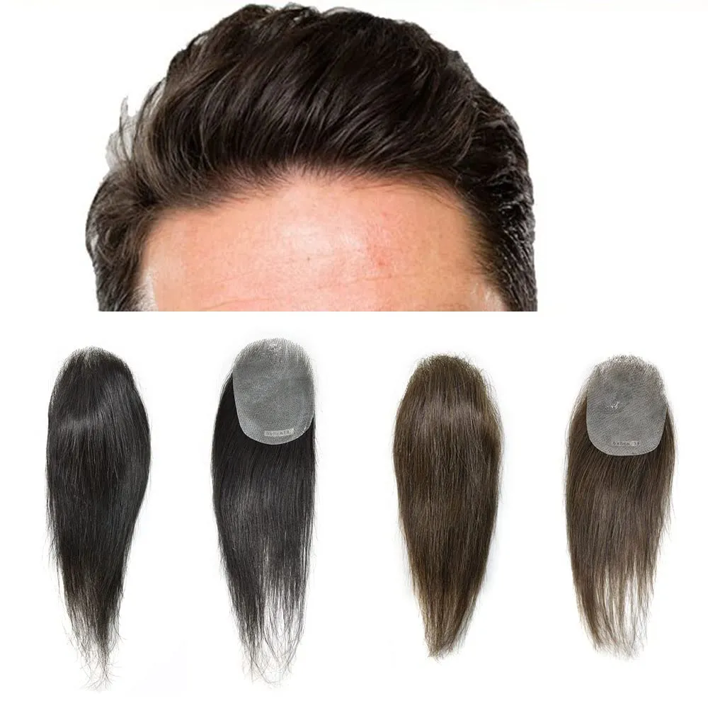 Bald Spot Hair Patch - Remy Human Hair - Natural Looking - 6cm x 8cm - #3 Dark Brown
