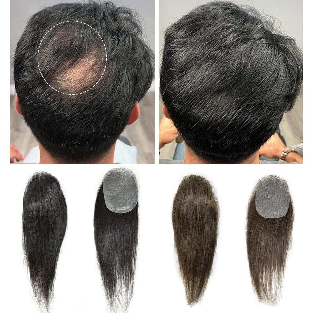 Bald Spot Hair Patch - Remy Human Hair - Natural Looking - 6cm x 8cm - #3 Dark Brown